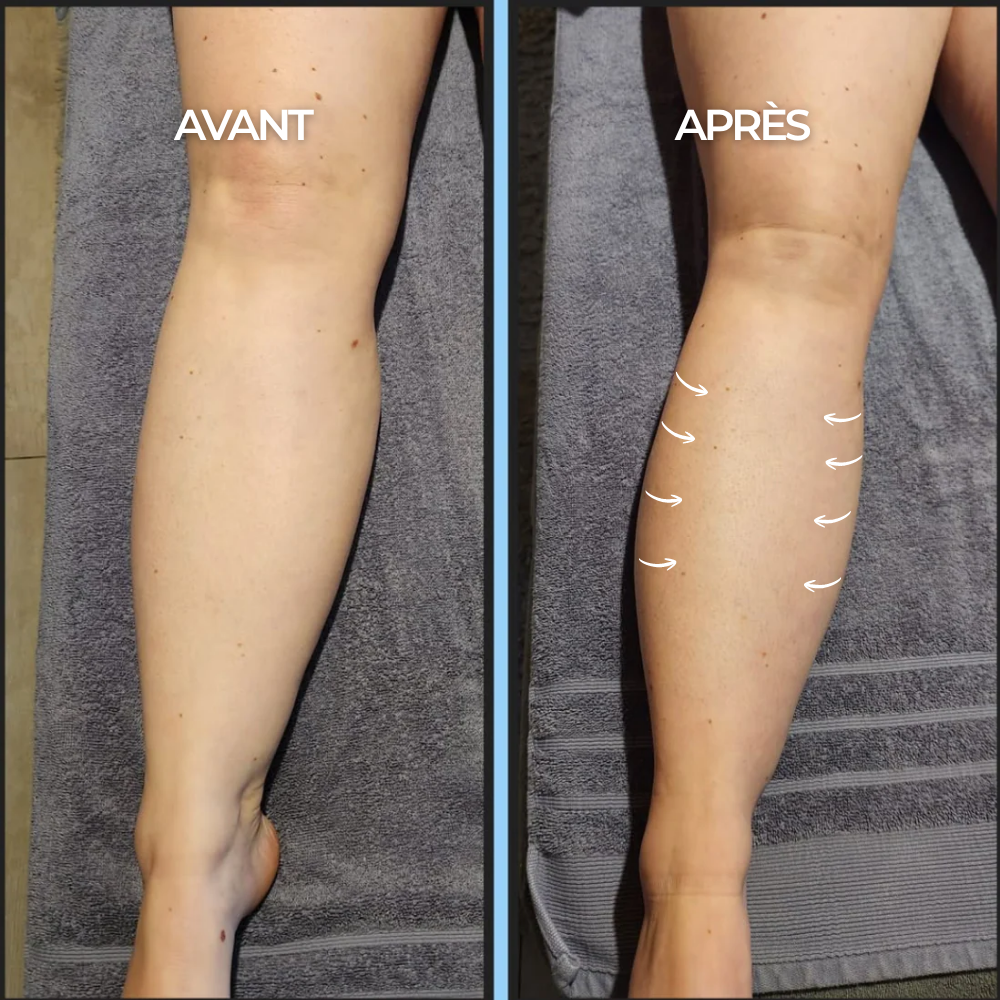 Gouttes Bien-Être Drainage Lymphatique