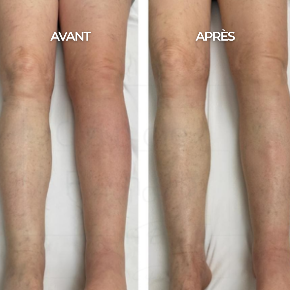 Chaussettes de Compression - Maison Lys