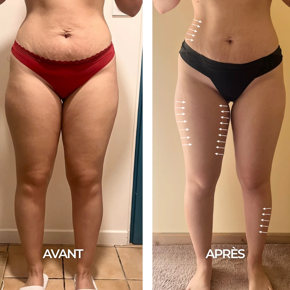 Gouttes Drainantes Cellulite – 35 ml