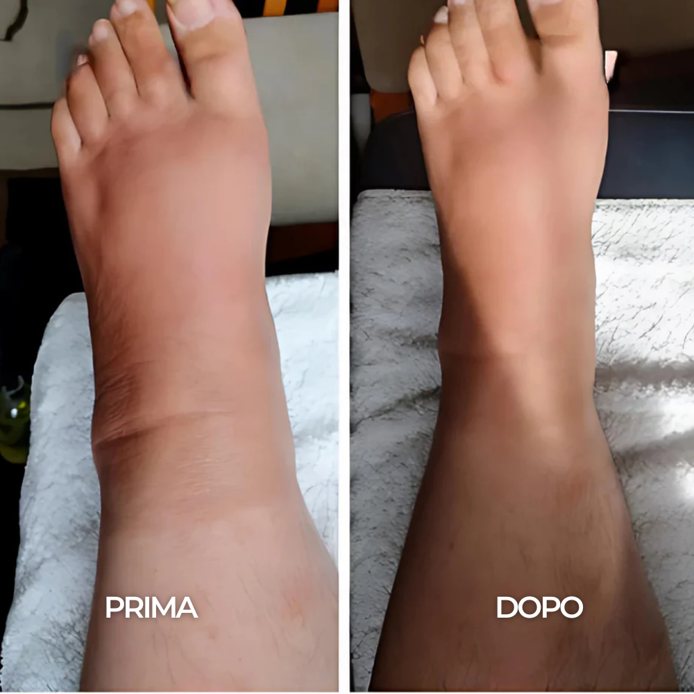 Gocce Benessere Drenaggio Linfatico - 35 ml